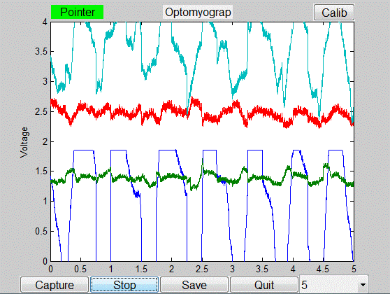 PC application displays optomygram waveform