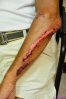 Wound2.JPG