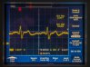 AFE-trace.jpg