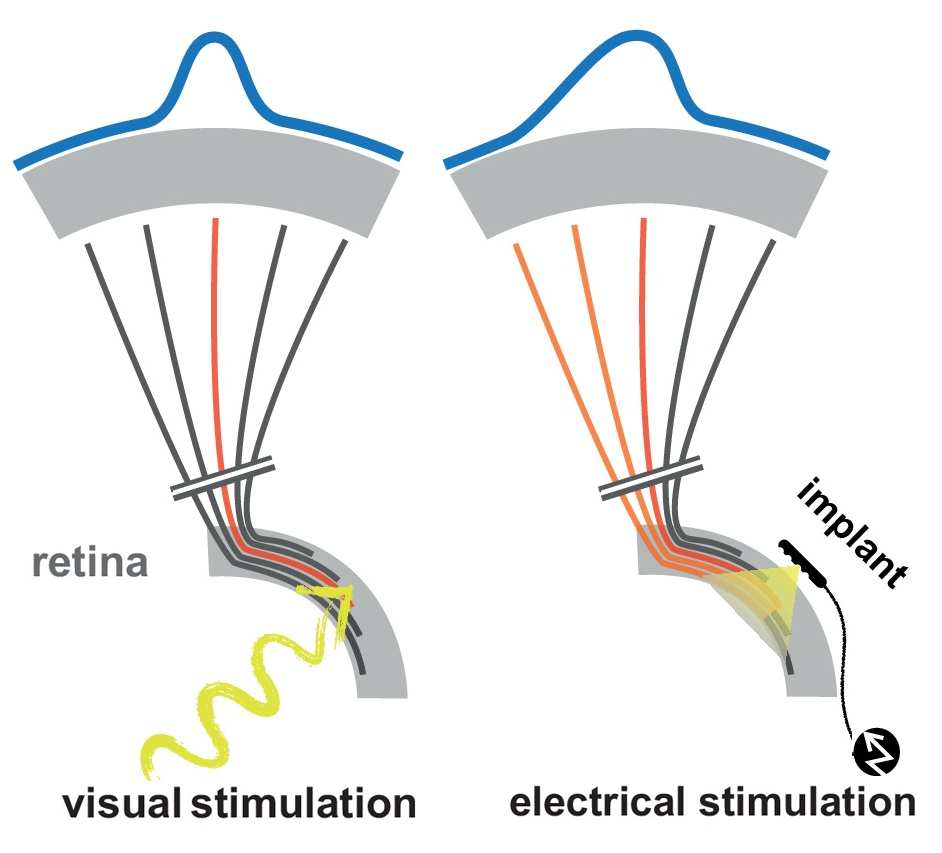 Improvement in the resolution of Retinal Prostheses