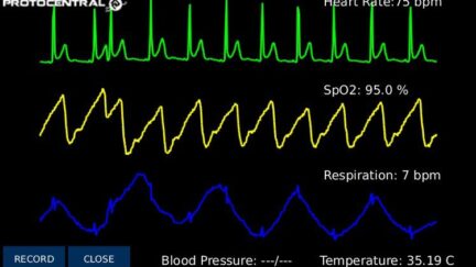 HealthyPi v3 – Health HAT for Raspberry Pi
