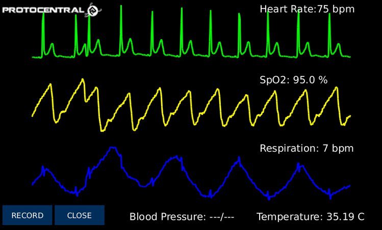 HealthyPi v3 – Health HAT for Raspberry Pi