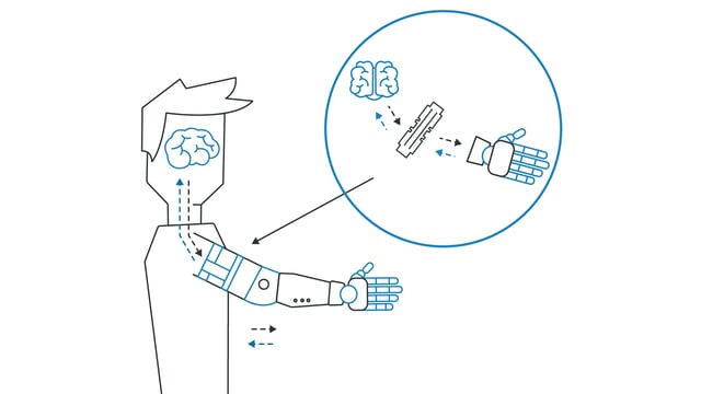 Prosthetics Feeling Is Now Possible With This Implantable Chip By Imec