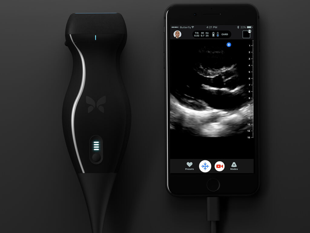 Butterfly IQ – Ultrasound Anywhere, Anytime