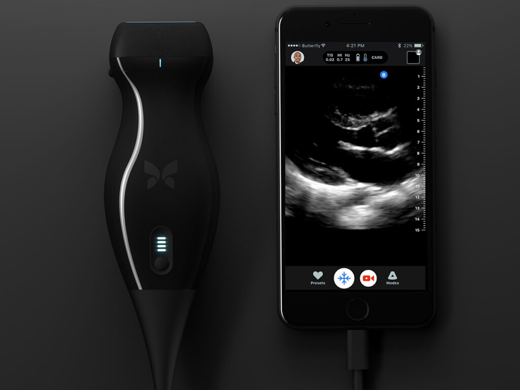 Butterfly IQ – Ultrasound Anywhere, Anytime Butterfly IQ – Ultrasound Anywhere, Anytime