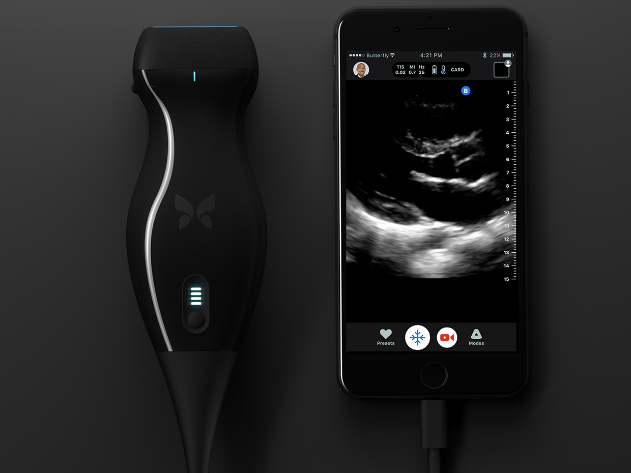 Butterfly IQ – Ultrasound Anywhere, Anytime