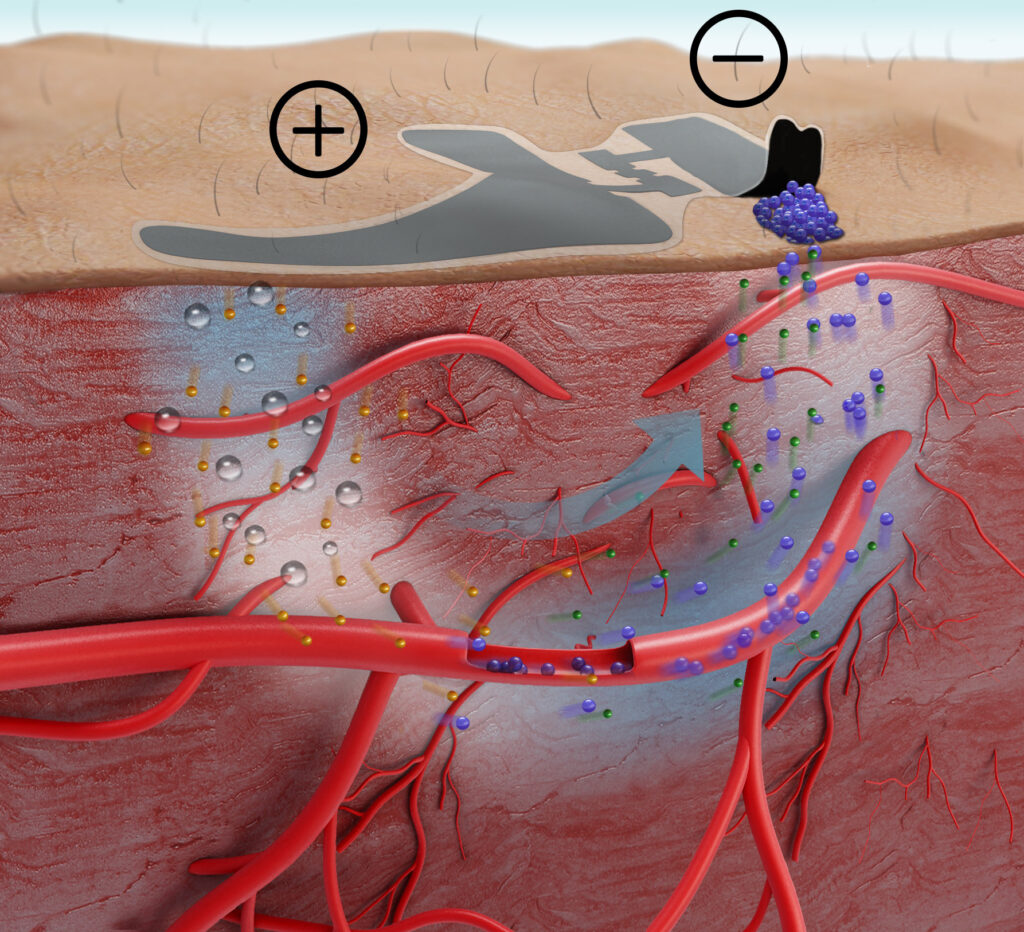 Schematic diagram of non-invasive blood glucose moniroring