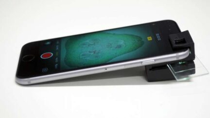 3D Printed Clip-On Turns Any Smartphone To A Household Microscope.
