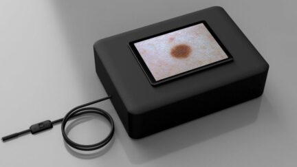 Ultra96 Skin Cancer AI Detection