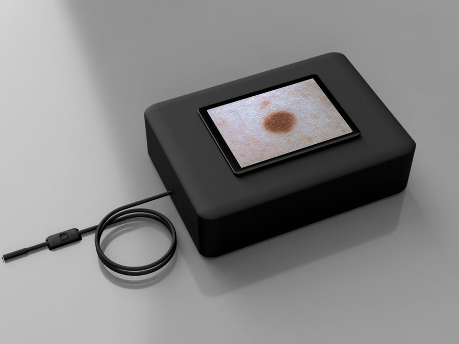 Ultra96 Skin Cancer AI Detection Ultra96 Skin Cancer AI Detection