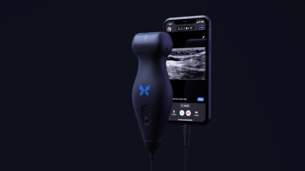 Advanced ultrasound-on-chip opens new applications