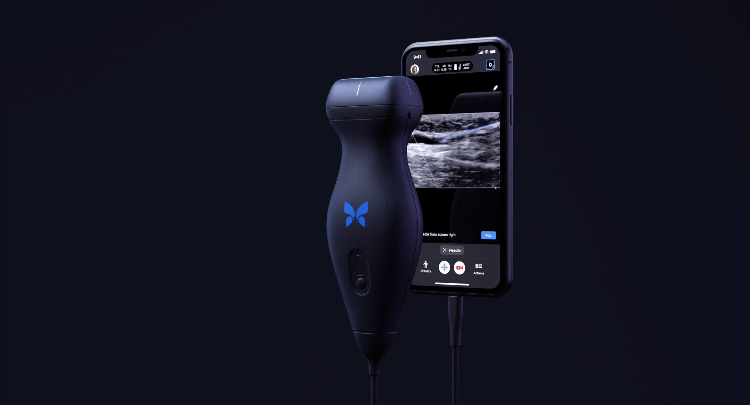 Advanced ultrasound-on-chip opens new applications Advanced ultrasound-on-chip opens new applications