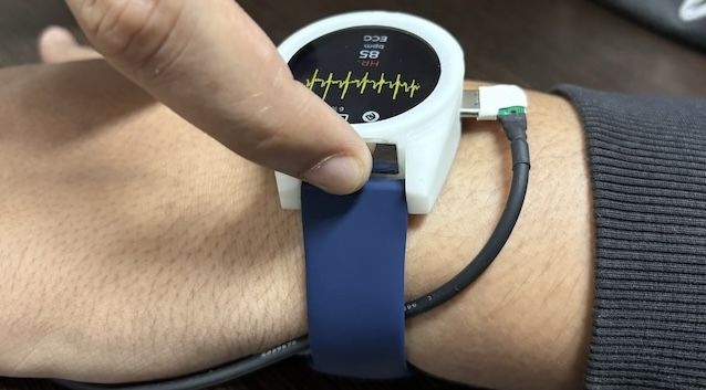Electrocardiogram (ECG)
